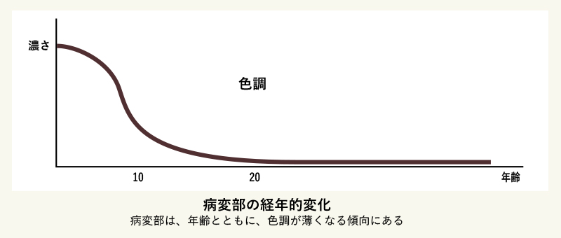 イラスト:まぶた、鼻・口付近、手足の関節付近などに症状のある方